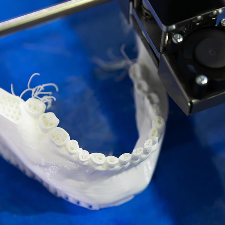 3D Oral Prosthetic Design and Printing