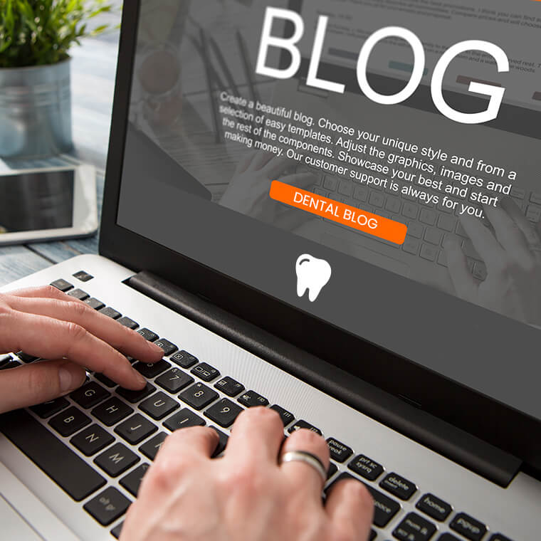 How to Create the Perfect Blog