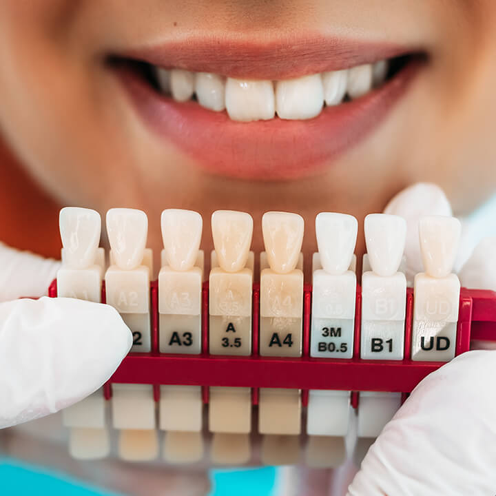Provide Your Dental Patients with Several Whitening Options